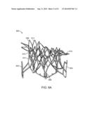 PROSTHETIC VALVE WITH ANTI-PIVOTING MECHANISM diagram and image