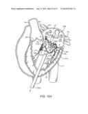 PROSTHETIC VALVE WITH ANTI-PIVOTING MECHANISM diagram and image