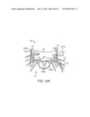 PROSTHETIC VALVE WITH ANTI-PIVOTING MECHANISM diagram and image