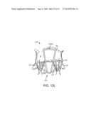 PROSTHETIC VALVE WITH ANTI-PIVOTING MECHANISM diagram and image