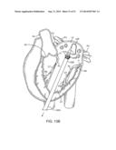 PROSTHETIC VALVE WITH ANTI-PIVOTING MECHANISM diagram and image