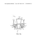 PROSTHETIC VALVE WITH ANTI-PIVOTING MECHANISM diagram and image