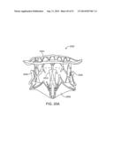 PROSTHETIC VALVE WITH ANTI-PIVOTING MECHANISM diagram and image