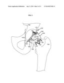 ARTIFICIAL JOINT COMPONENTS INCLUDING MECHANIZED SYNOVIAL FLUID DEFLECTING     STRUCTURES AND PARTICLE RETAINING STRUCTURES diagram and image