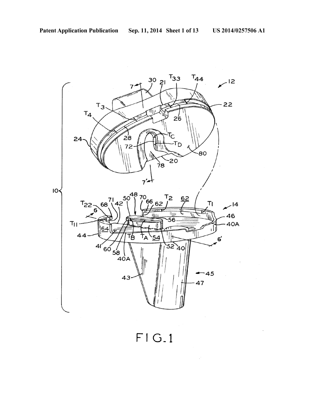 TIBIAL PROSTHESIS - diagram, schematic, and image 02