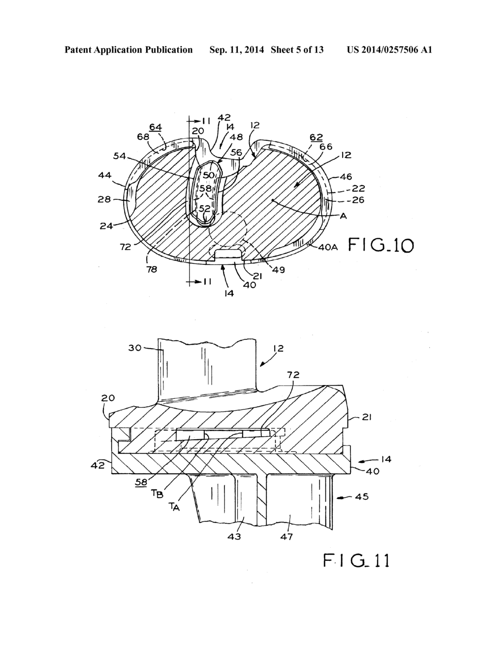 TIBIAL PROSTHESIS - diagram, schematic, and image 06