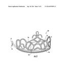 TIARA WITH INTERCHANGEABLE DISPLAY ELEMENTS diagram and image