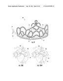 TIARA WITH INTERCHANGEABLE DISPLAY ELEMENTS diagram and image