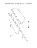 Interlocking Impact Protection System For Contact Sports diagram and image