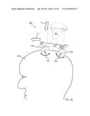 Shavers diagram and image