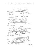 Shavers diagram and image