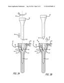 DEVICE FOR RECONDITIONING GOLF TEES diagram and image