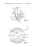 DEVICE FOR RECONDITIONING GOLF TEES diagram and image