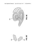 SOLE STRUCTURES AND ARTICLES OF FOOTWEAR HAVING A LIGHTWEIGHT MIDSOLE     MEMBER WITH PROTECTIVE ELEMENTS diagram and image