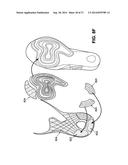 SOLE STRUCTURES AND ARTICLES OF FOOTWEAR HAVING A LIGHTWEIGHT MIDSOLE     MEMBER WITH PROTECTIVE ELEMENTS diagram and image