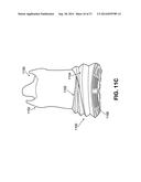 SOLE STRUCTURES AND ARTICLES OF FOOTWEAR HAVING A LIGHTWEIGHT MIDSOLE     MEMBER WITH PROTECTIVE ELEMENTS diagram and image