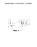 Insert Holding System diagram and image