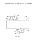 ULTRASONIC FLOWMETER WITH INTEGRALLY FORMED ACOUSTIC NOISE ATTENUATING     FEATURE diagram and image