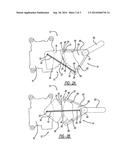 GEAR WITH IDLE ZONES diagram and image