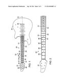 STRINGED MUSICAL INSTRUMENT WITH SURFACE MOUNTED NECK INSERT diagram and image
