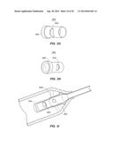 Remote Treatment System diagram and image