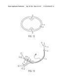 ASPIRATION CATHETERS, SYSTEMS, AND METHODS diagram and image