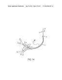 ASPIRATION CATHETERS, SYSTEMS, AND METHODS diagram and image