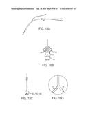 ASPIRATION CATHETERS, SYSTEMS, AND METHODS diagram and image