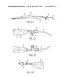 ASPIRATION CATHETERS, SYSTEMS, AND METHODS diagram and image