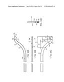 ASPIRATION CATHETERS, SYSTEMS, AND METHODS diagram and image