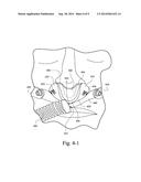 PATIENT INTERFACE SYSTEMS FOR ENSURING EFFECTIVE SEAL diagram and image