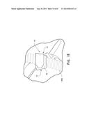 NASAL ASSEMBLY diagram and image