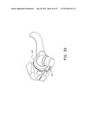 NASAL ASSEMBLY diagram and image