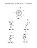 INTRAUTERINE CONTRACEPTIVE DEVICES diagram and image