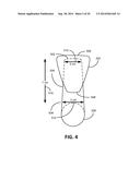 RECTOCELE AND CYSTOCELE DEVICE diagram and image