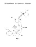 RECTOCELE AND CYSTOCELE DEVICE diagram and image