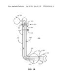 RECTOCELE AND CYSTOCELE DEVICE diagram and image