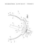 Endotracheal Tube Holding Device with Bite Block diagram and image