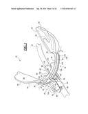 Endotrachael Tube Holding Device with Bite Block diagram and image