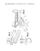 Endotrachael Tube Holding Device with Bite Block diagram and image