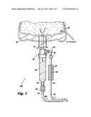 Recirculating Cooling System For Energy Delivery Device diagram and image