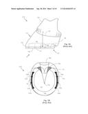 Horseshoe assembly and a method of mounting the same onto a horse hoof diagram and image