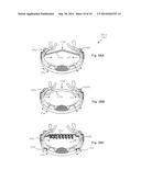 Horseshoe assembly and a method of mounting the same onto a horse hoof diagram and image