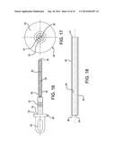 Controlled Compression Tube diagram and image