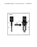 Cannulas, Collars for Implantable Devices, and Corresponding Systems and     Methods diagram and image