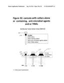 Cannulas, Collars for Implantable Devices, and Corresponding Systems and     Methods diagram and image