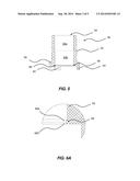 SUPPORT FIXTURE FOR ACID ETCHING PCD CUTTING INSERTS diagram and image