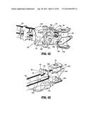 SURGICAL STAPLING APPARATUS diagram and image