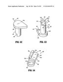 SURGICAL STAPLING APPARATUS diagram and image