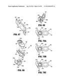 SURGICAL STAPLING APPARATUS diagram and image